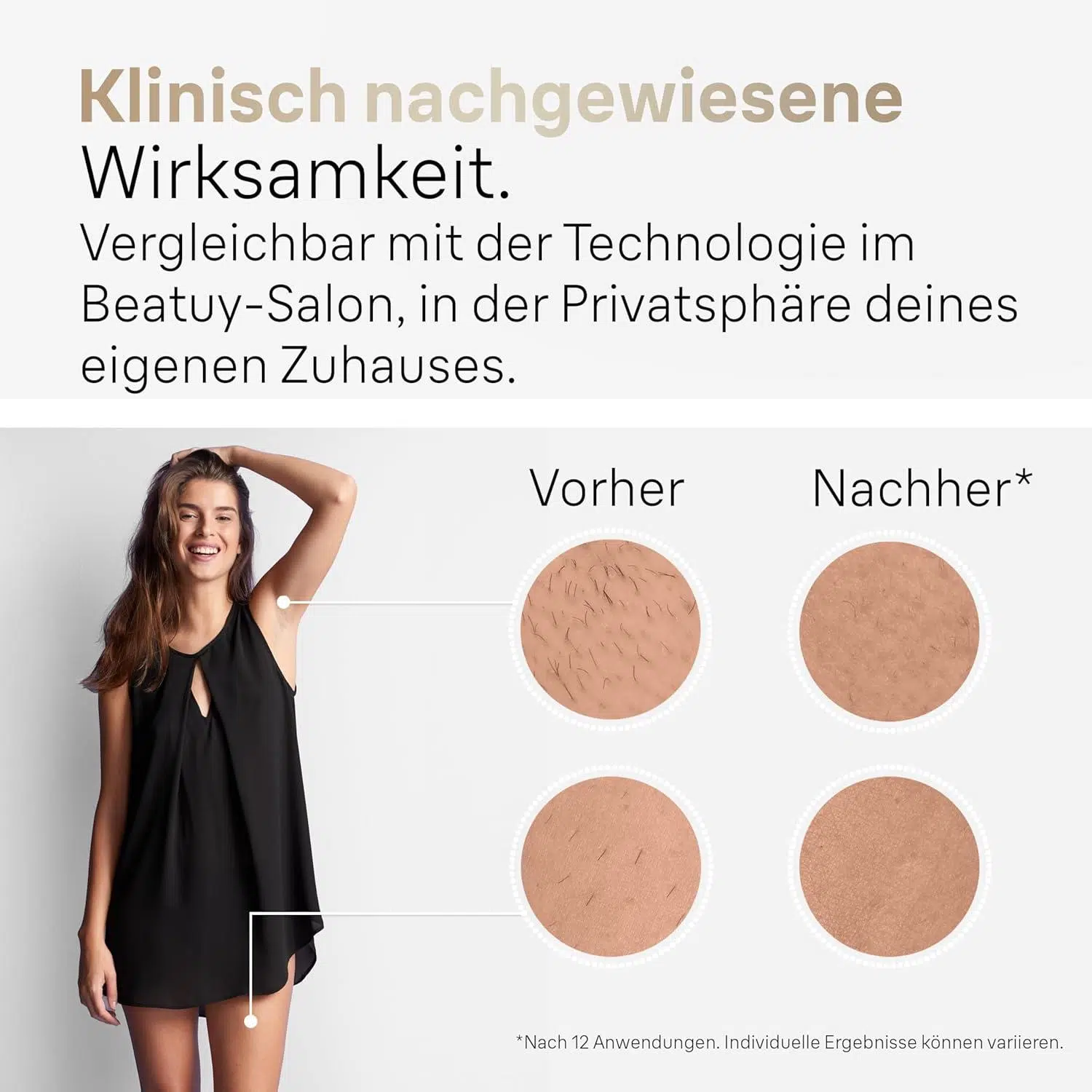 Infografik Zur Anwendungsgeschwindigkeit Des Ipl-Geräts: 10 Minuten Ganzkörperbehandlung