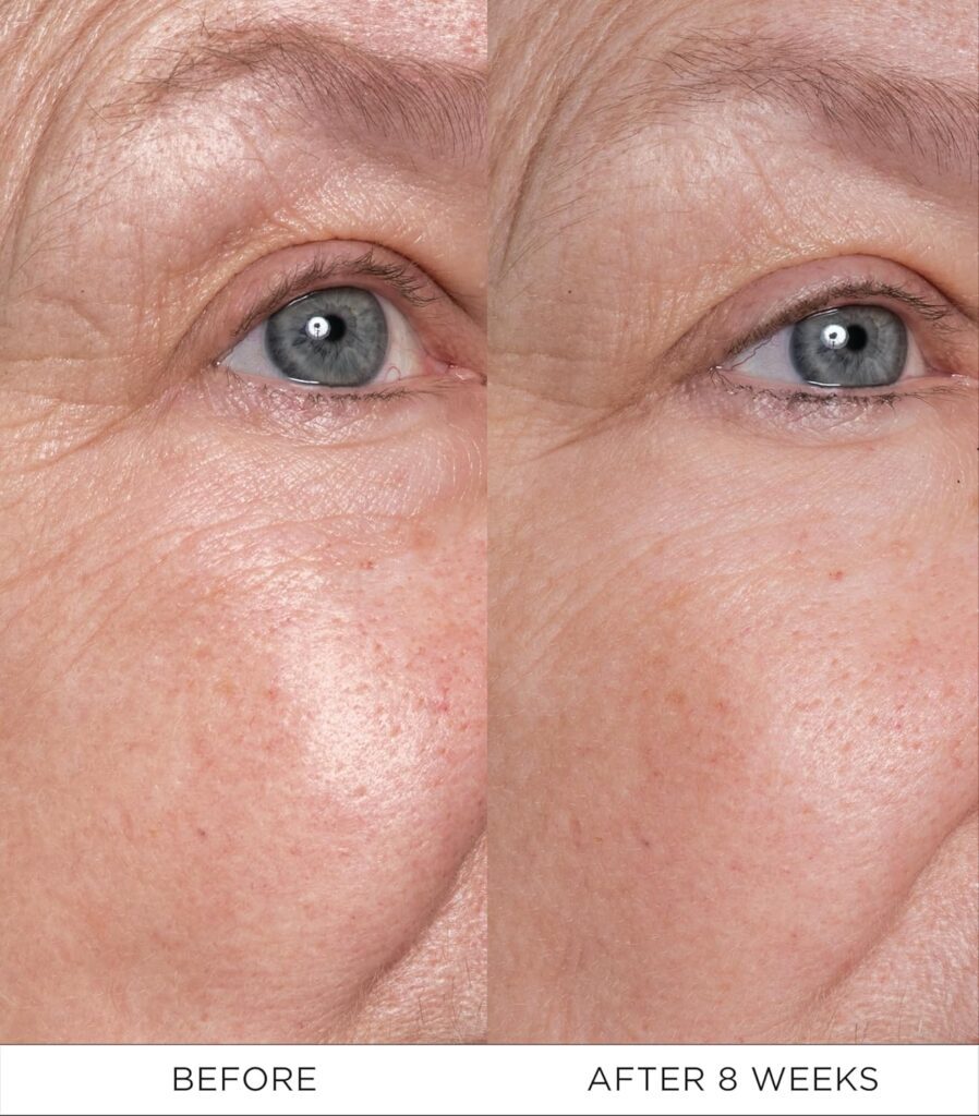 Edles Allheilmittel Eye Lift Konzentrat In Eleganter Verpackung